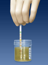Autotests urinaires - AUTOMESURE Il est possible d'analyser soi-même les  urines à l'aide de bandelettes urinaires. C'est simple et utile dans  plusieurs situations. Le résultat de ces autotests doit souvent être  confirmé